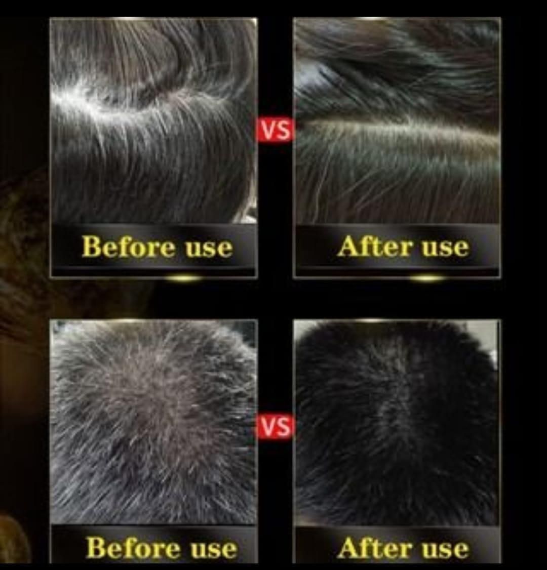 3-IN-1 BLACK HAIR DYE SHAMPOO (AYURVEDIC NO SIDE EFFECT) - Buy 1 Get 1 Free 🔥