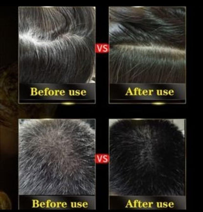 3-IN-1 BLACK HAIR DYE SHAMPOO (AYURVEDIC NO SIDE EFFECT) - Buy 1 Get 1 Free 🔥